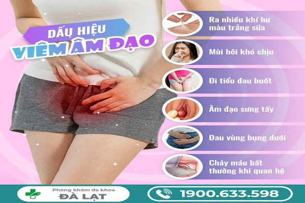 Hình ảnh minh họa